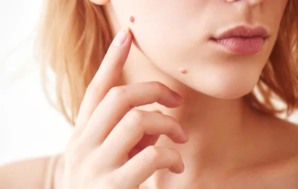 Skin Check 2